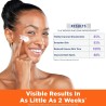 Palmer's Skin Success Anti-Dark Spot Nighttime Fade Cream with Retinol & Niacinamide, Dark Spot Corrector for Face