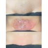Bikini Waxing Bikini Waxing