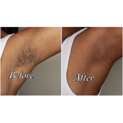 Armpit Waxing