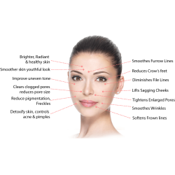 Microneedling facials